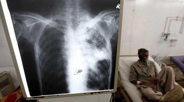 La enfermedad de la pobreza | El año pasado murieron 71 personas por tuberculosis en Salta